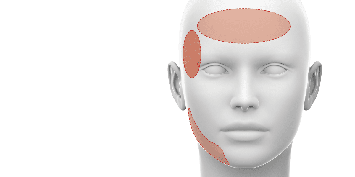 How to treat TMD/TMJ Related Issues | Advanced BTX Training